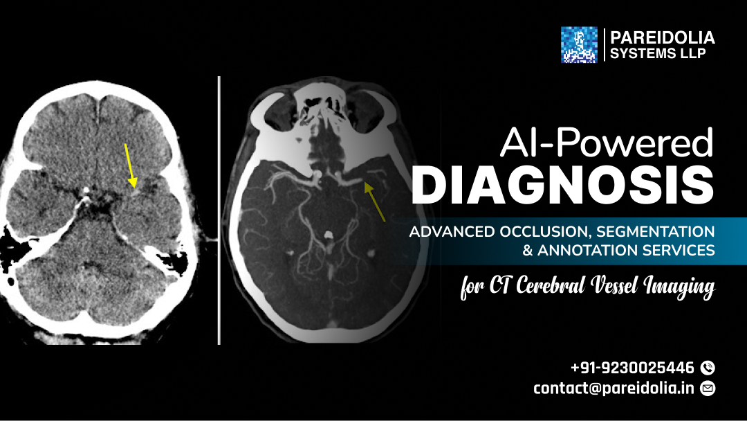CT Cerebral Vessel Imaging
