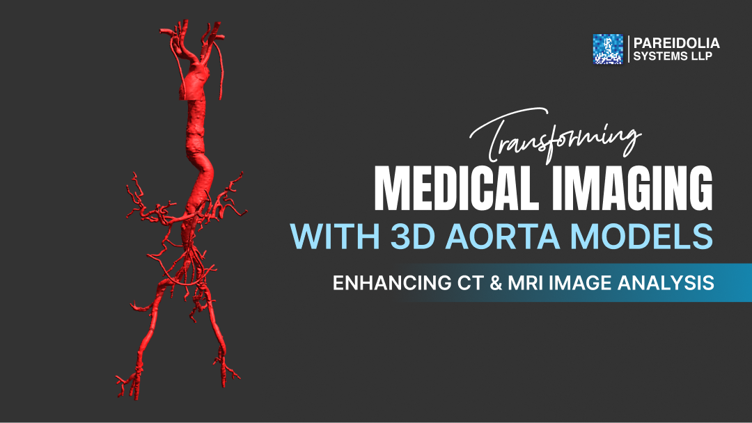 3D Aorta Models