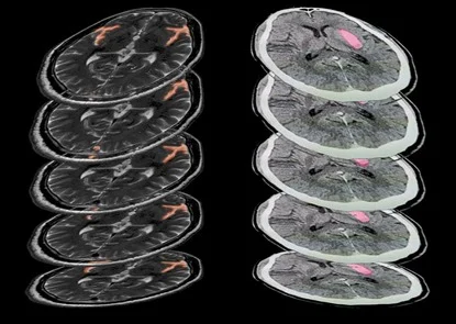 Medical Image Annotation Services 