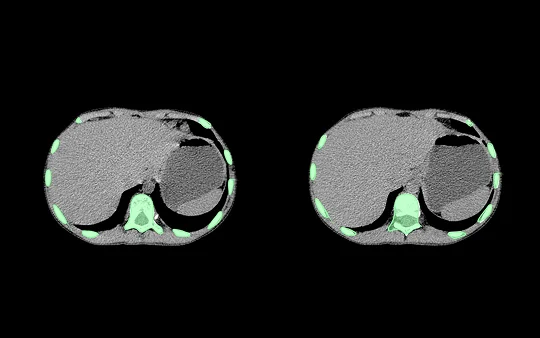 Deep Learning in Medical Imaging