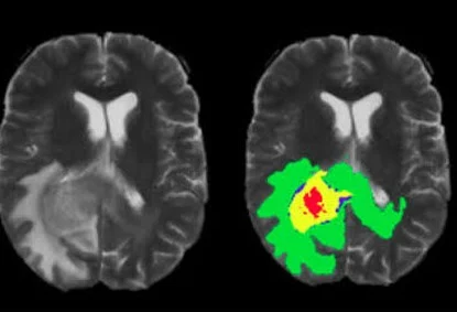Medical Image Annotation Services 