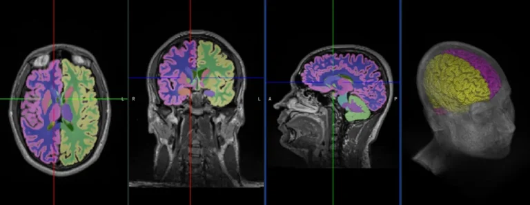 Deep Learning in Medical Imaging