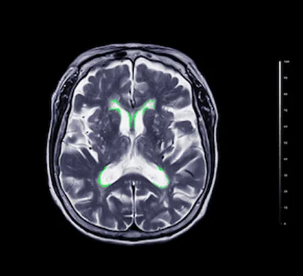 Deep Learning in Medical Imaging