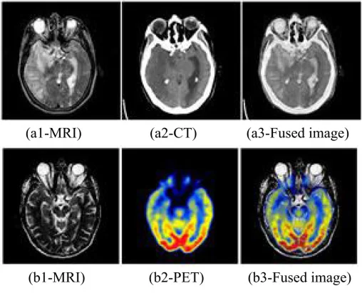 Medical Imaging Analysis