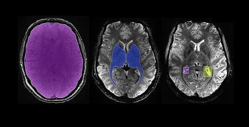 Medical Imaging Analysis