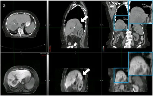 Medical Imaging Analysis