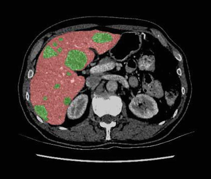 3D Image Segmentation