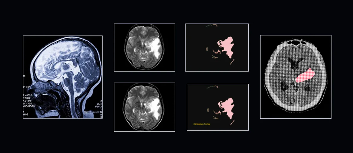 Medical Data Annotation