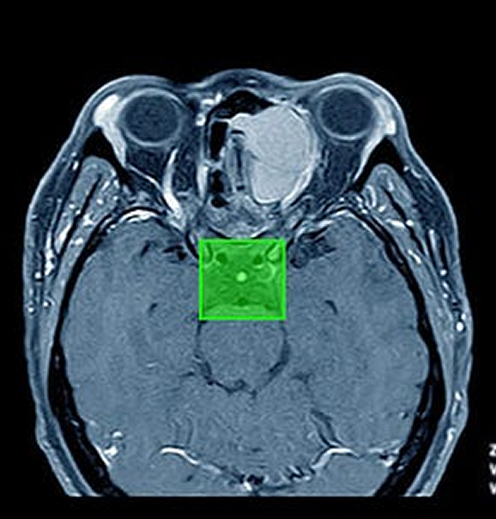Medical Data Annotation
