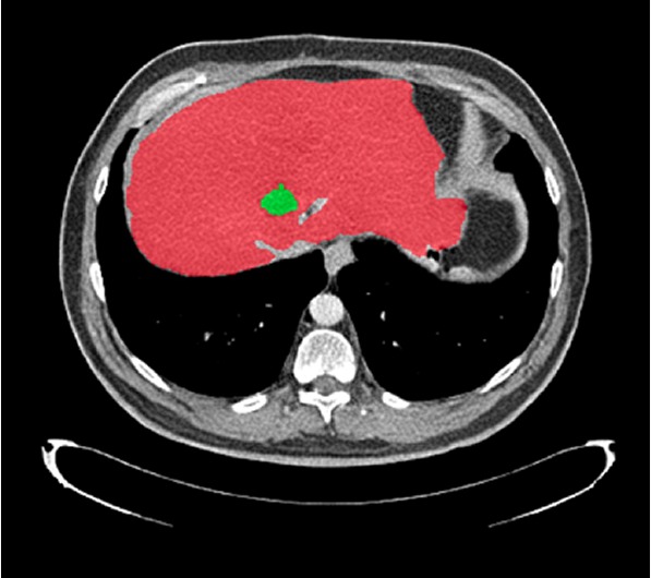 Medical Image Annotations