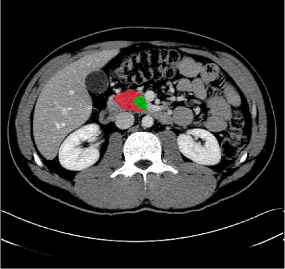 Medical Image Annotations