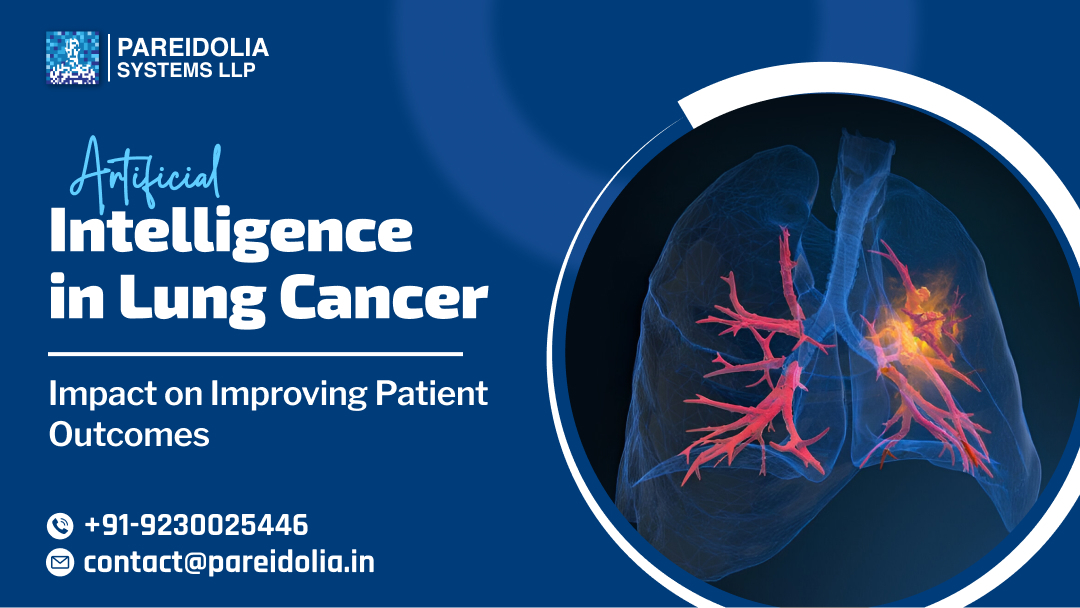 Artificial intelligence in lung cancer