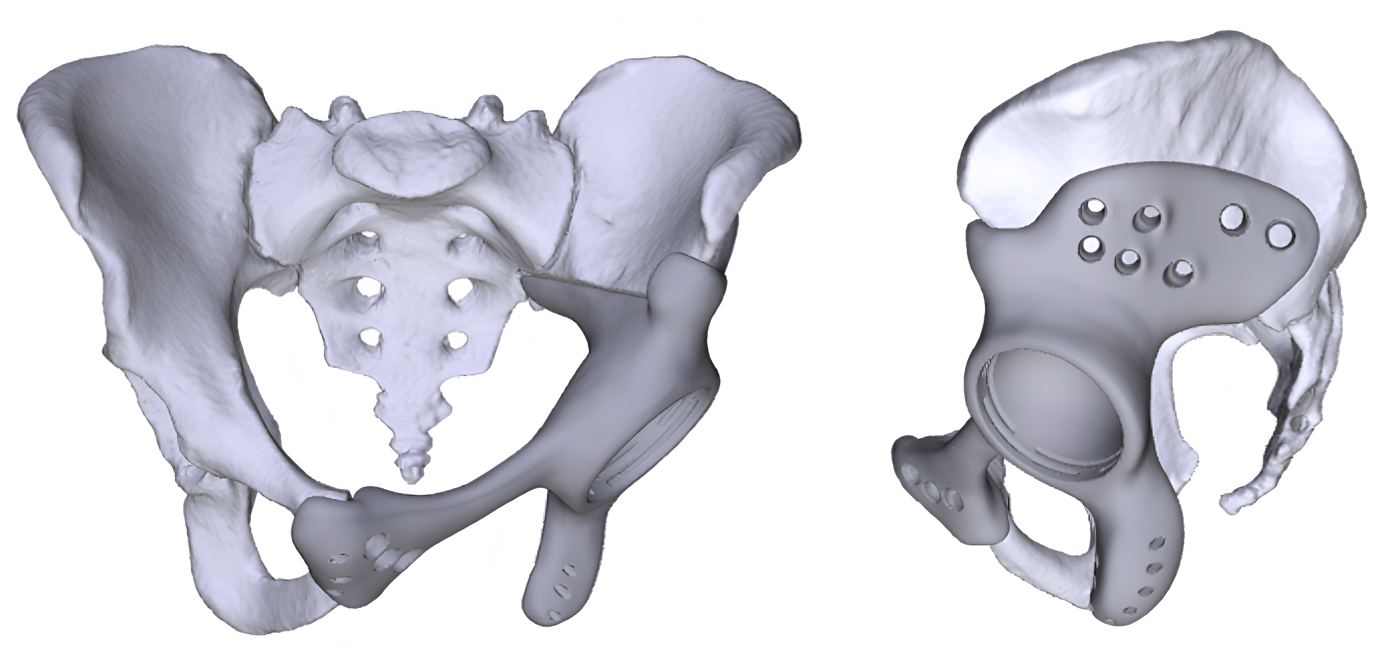 3D Medical Imaging