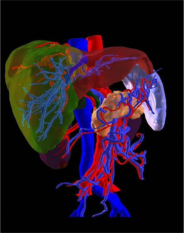 3D Medical Imaging