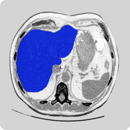 Medical data annotation company