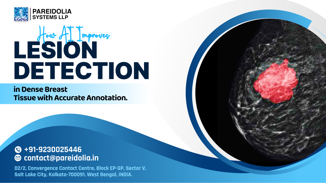 breast cancer screening