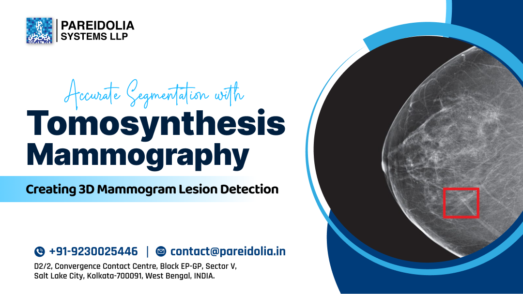 AI in Breast Cancer Imaging
