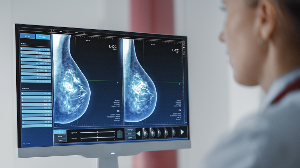 breast cancer screening