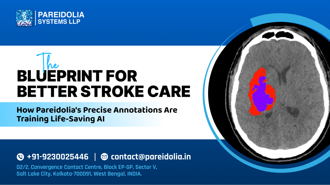 AI in Stroke Care
