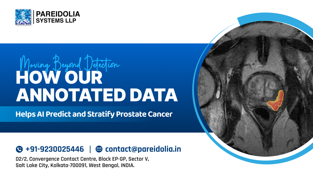AI in Prostate Cancer