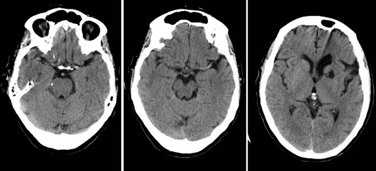 Ai medical diagnosis
